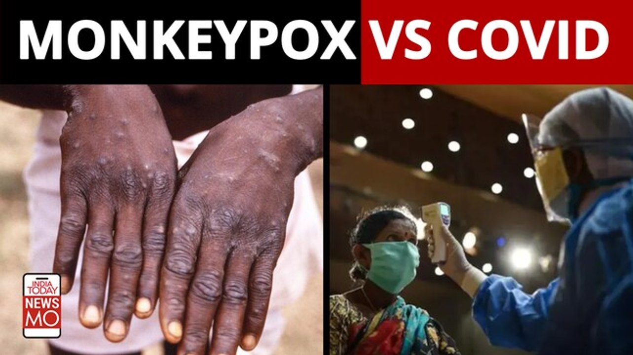 Monkeypox vs Covid: Which is more deadly?