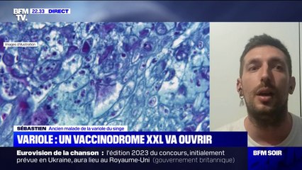 Variole du singe: "La maladie n'est pas mortelle, mais elle est extrêmement douloureuse", raconte Sébastien