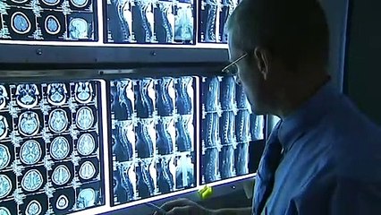 New study indicates majority off migraine sufferers are undiagnosed