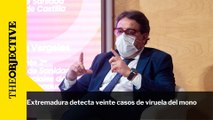 Extremadura detecta veinte casos de viruela del mono