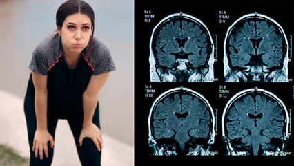 खाली पेट दौड़ने से क्या होता है | खाली पेट दौड़ने के नुकसान | Boldsky | *Health