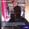 Menyayat Hati! Wanita Ini Rela Botak Demi Bebas dari Ketombe