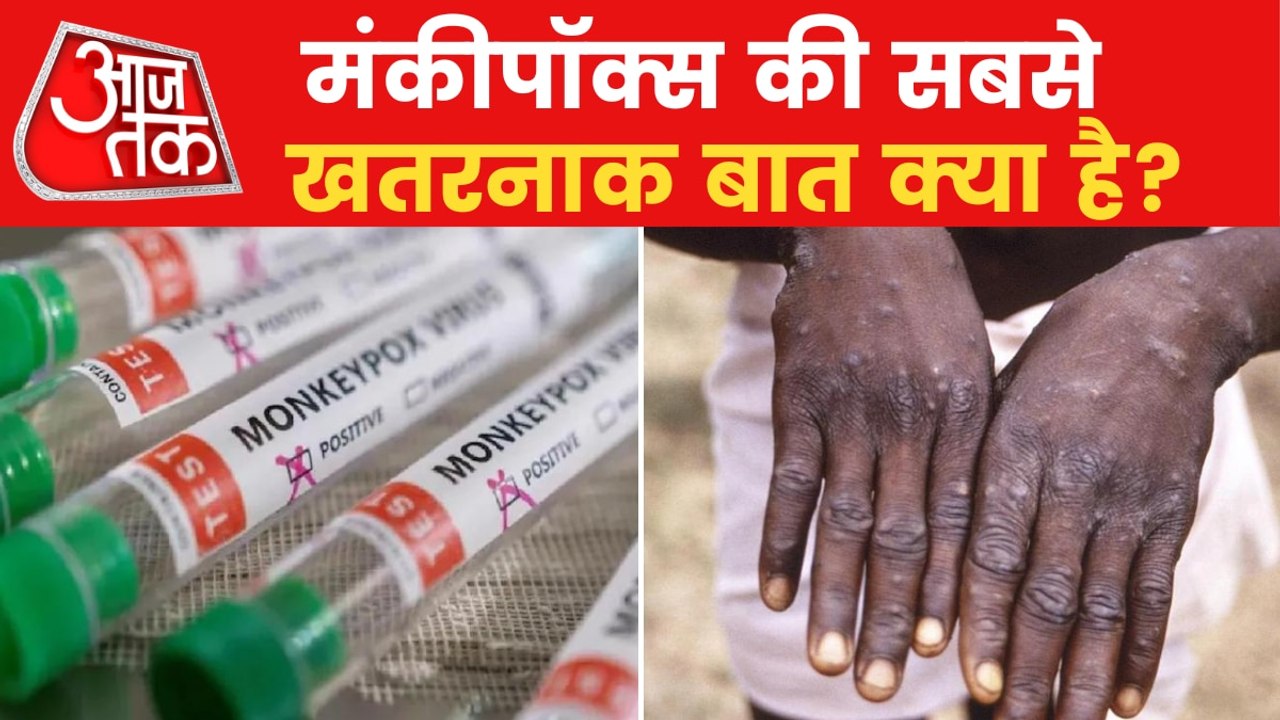 Why Monkey Pox is as dangerous as Corona Virus?