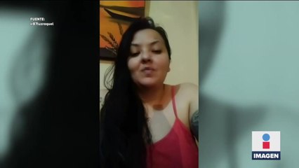 Luz Raquel se habría prendido fuego con alcohol