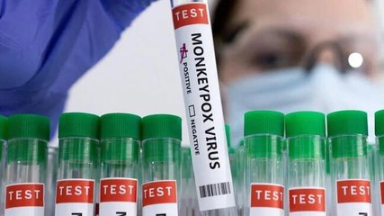 Another patient with monkeypox symptoms admitted to Delhi's LNJP hospital, reports awaited