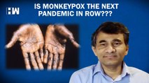 Is Monkeypox The Next Pandemic? In Talks With Dr Sangram Patil| Skin Disease Symptom| Virus| Health