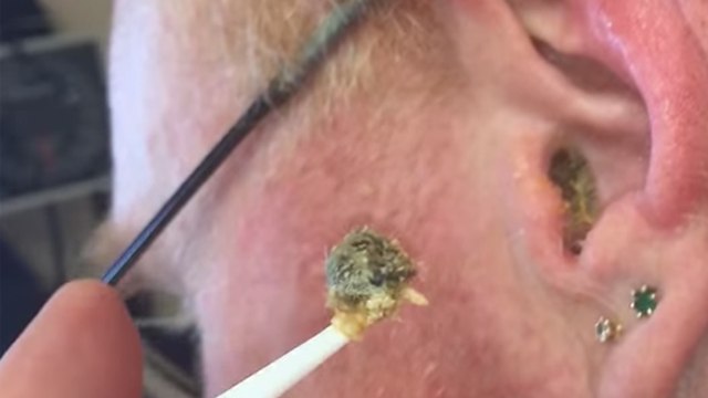 कान का साफ करने का सही तरीका, कानों से मैल निकलते समय भूलकर भी न करें ये गलतियां | Boldsky *Health