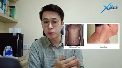 Jaga-Jaga Gelembung Air, Boleh Terjadinya Kayap