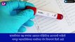 Swine Flu in Maharashtra: नागपुर मध्ये आढळले  Swine Flu चे 16 रुग्ण, प्रशासनाच्या चिंतेत वाढ