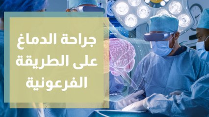 جراحة الدماغ على الطريقة الفرعونية أنجح من الأدوية