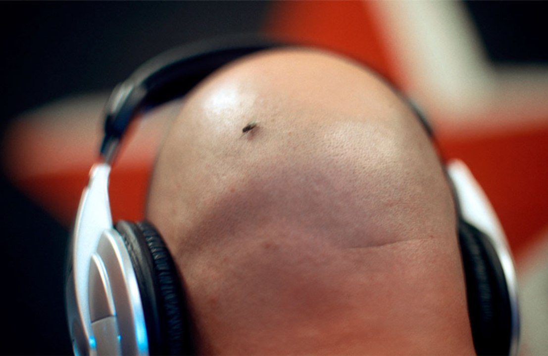 Potential baldness 'cure' discovered!