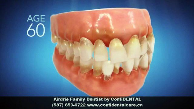 Invisalign Dentist Airdrie AB