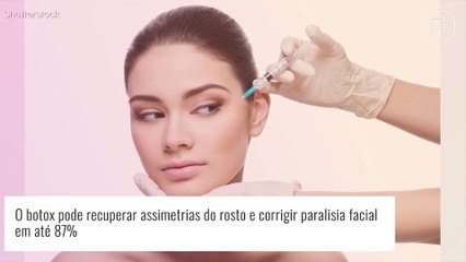 Download Video: Quem já teve paralisia facial pode fazer botox? Procedimento estético pode ajudar em tratamento, diz expert