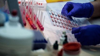 Toprakta bulunan ölümcül bakteri panik yarattı! Hastalığın ilk belirtisi ateş