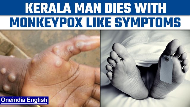 Kerala man with Monkeypox-like symptoms dies, high-level inquiry initiated | Oneindia News *News