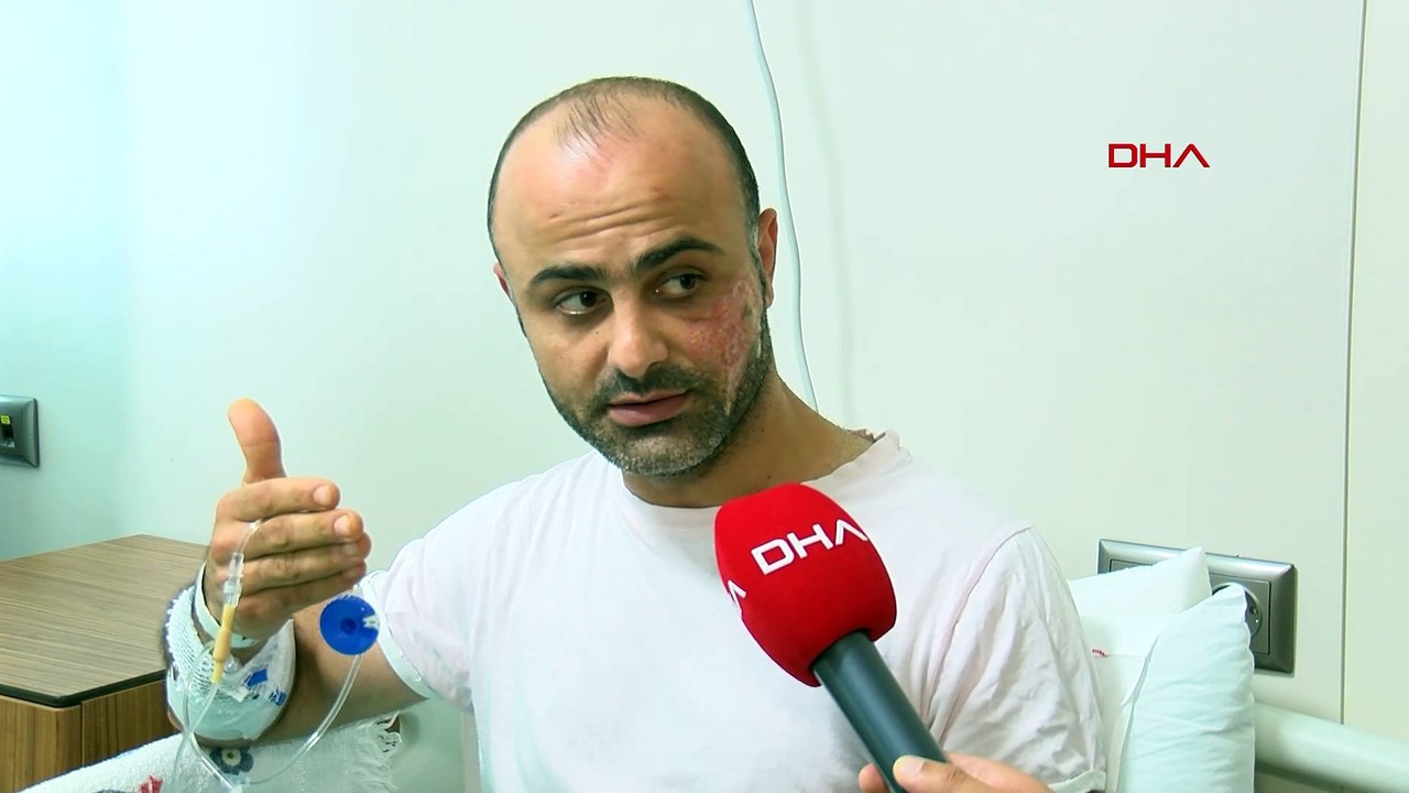 Yanaklarındaki kıllardan kurtulmak isterken hayatı kabusa döndü