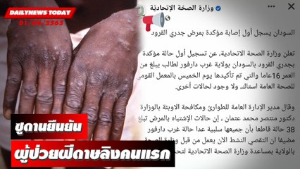 ซูดานยืนยันผู้ป่วยฝีดาษลิงคนแรก แอฟริกาจี้ขอวัคซีน | DAILYNEWS TODAY 01/08/65