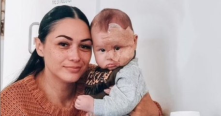 Une mère insultée sur les réseaux sociaux pour avoir fait retirer la tache de naissance de son fils au laser