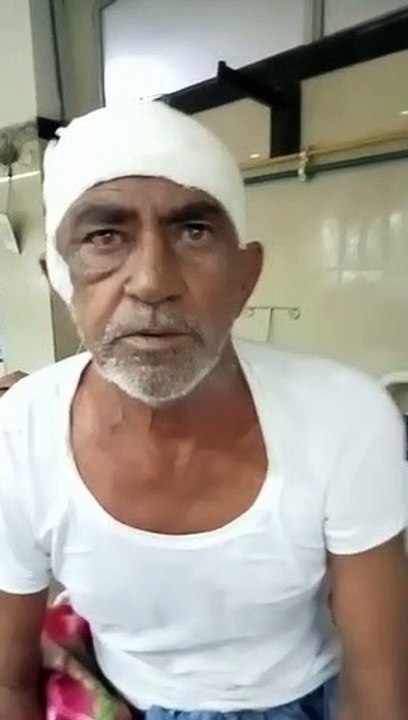 दिमाग की धमनी पर बने गुब्बारे का क्लिपिंग से ऑपरेशन