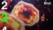 9 questions très simples sur la variole du singe