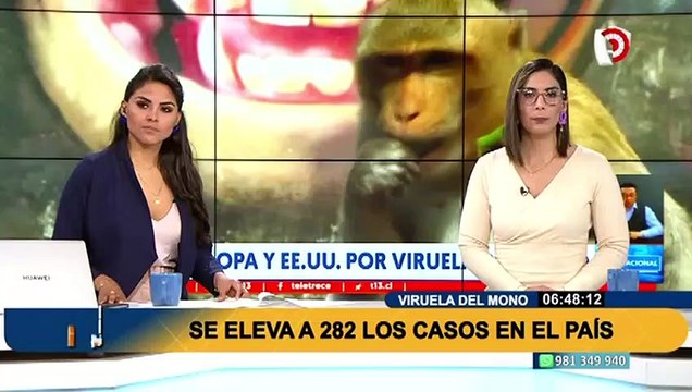 Viruela del mono: Ministerio de Salud informa que casos confirmados llegan a 282 en todo el país