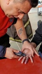 Jovem com dedo estrangulado por anel é socorrida por bombeiros