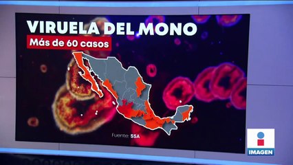 Detectan el primer caso de viruela del mono en Michoacán