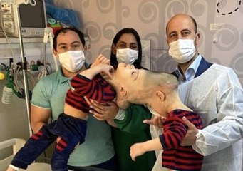 3-Year-Old Conjoined Twins With Fused Brains Separated in Historic Virtual Reality Surgery