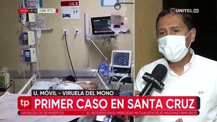 Tres personas están en observación por contacto con paciente confirmado con viruela del mono en Santa Cruz