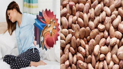 पथरी में भूलकर भी न खाएं ये दाल सेहत पर होगा बुरा असर । Pathri Me Na Khaye Ye Daal ।  *Health