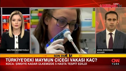 Bakan Koca: Türkiye'de 5 maymun çiçeği vakası tespit edildi