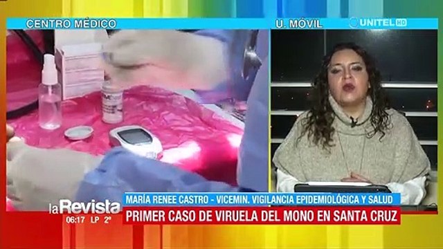 Salud identificó a tres sospechosos que tuvieron contacto con el primer caso de la viruela del mono en Bolivia