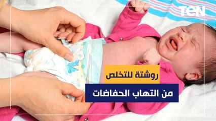 روشتة ذهبية للتخلص من التهاب الحفاضات عند الأطفال