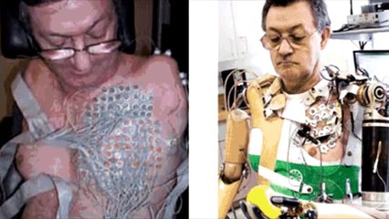 TOP 10 Personas Cyborgs De La Vida Real