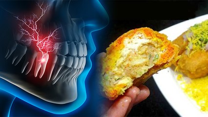 दांत दर्द में क्या नहीं खाना चाहिए । दांत दर्द में इन चीजों का सेवन खतरनाक । Boldsky *Health