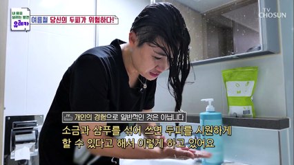 힘든 육아로 방치했던 탈모➜원형 탈모로 변한 주인공 TV CHOSUN 20220807 방송