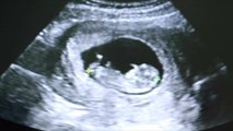 Georgia Rules Embryos Can Now Be Listed As Dependents on Tax Returns