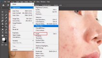 High End Skin Retouching Photoshop Tutorial |Remove Pimples | Photoshop Tutorial