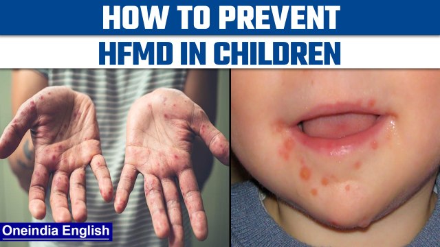 What are HFMD diseases | How to prevent HFMD in children| Oneindia News *News