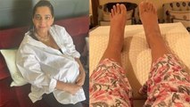 Sonam Kapoor Delivery से पहले हालत खराब,Pregnancy में Legs Swelling क्यों होती है । *Health