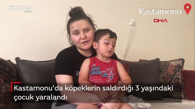 Kastamonu'da köpeklerin saldırdığı 3 yaşındaki çocuk yaralandı