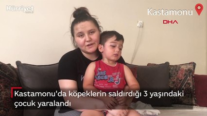 Kastamonu'da köpeklerin saldırdığı 3 yaşındaki çocuk yaralandı