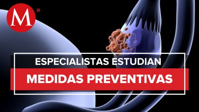 La aspirina podría reducir riesgo de cáncer de ovario