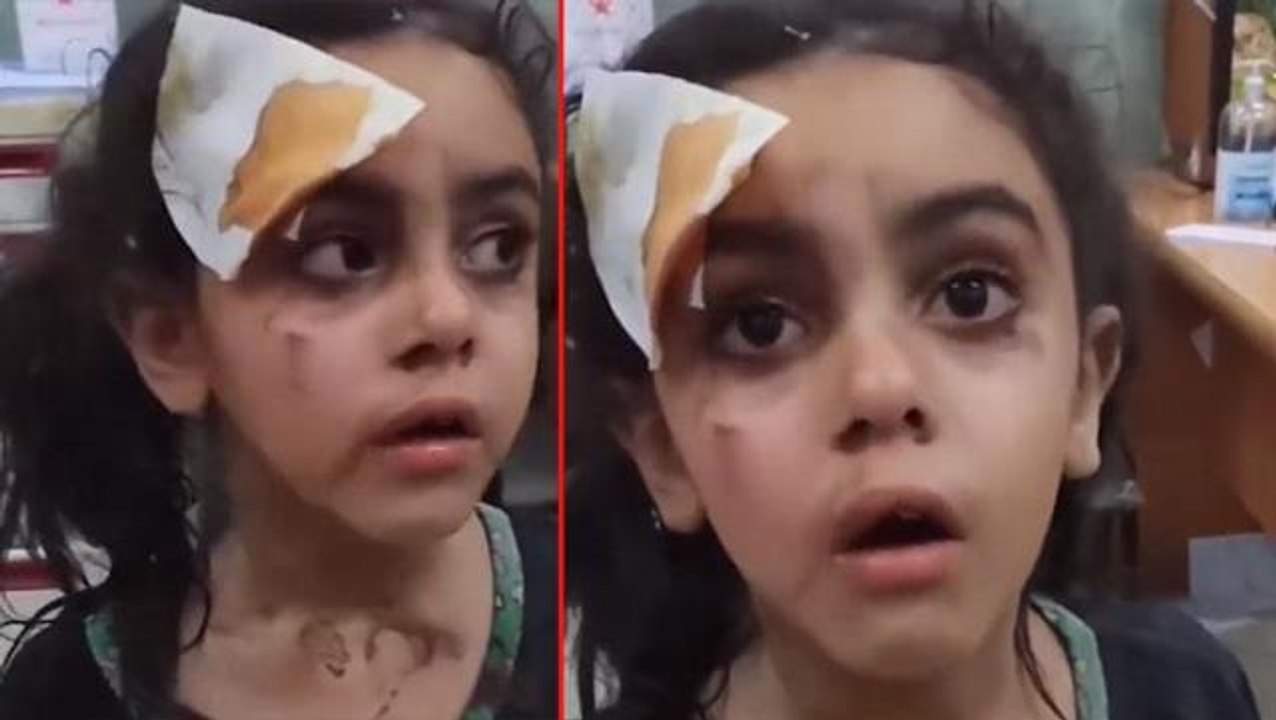 İsrail'in bombalarından yaralı kurtulan küçük kızdan cesur tepki: "İsrail devlet bile değil onlar sadece çocuk katili"