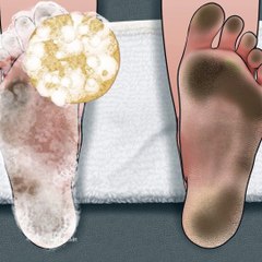 대리만족 ! 발 각질, 티눈 케어 애니메이션 | Feet exfoliation, corn removal animation [ASMR]