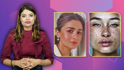 Face Freckles क्या है, Janvhi Kapoor Alia Bhatt ने किया Follow ये Trend|Boldsky*Entertainment
