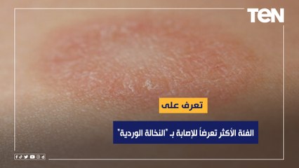 الفئة الأكثر تعرضاً للإصابة بـ "النخالة الوردية"