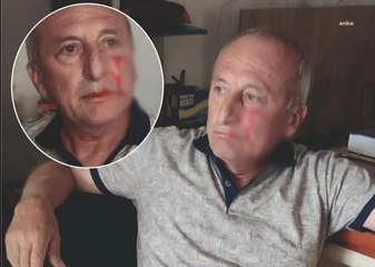 Osmaniye yerel haberi: Osmaniye'de CHP'li Yarbaşı Belediye Başkanı Mustafa Kaynar Saldırıya Uğradı