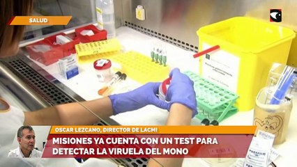 Misiones ya cuenta con un test para detectar la viruela del mono