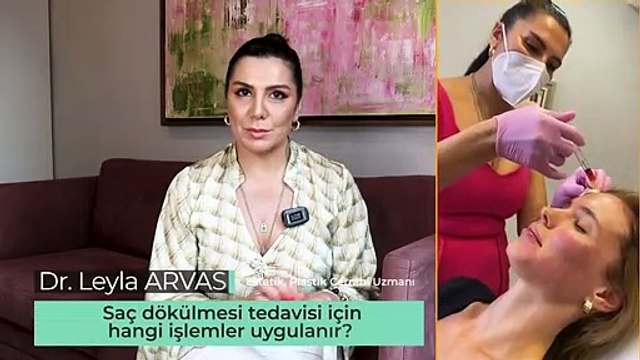 Saç dökülmesi için en etkili tedavi yöntemleri nelerdir? #sacekimi #saçdökülmesi #fue